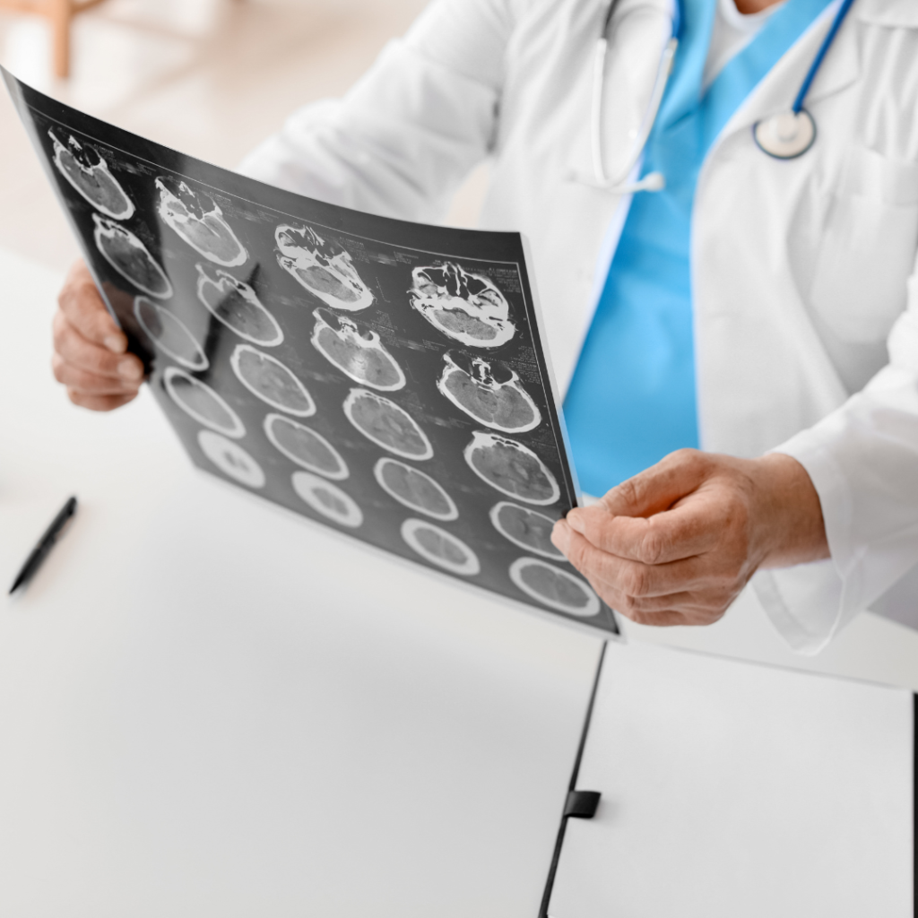 Dra. Rafaella Monteiro Silva Pinto | Neurologista em São Paulo | Neurologista São Paulo | Neurovascular em São Paulo | Neurovascular São Paulo | Medicina do Sono em São Paulo | Medicina do Sono São Paulo | Especialista em Sono | Especialista em AVC | Neurologista Online | Neurologia Sem Fronteiras | Consulta Online com Neurologista | Neurologista Teleconsulta | Teleconsulta de Neurologia