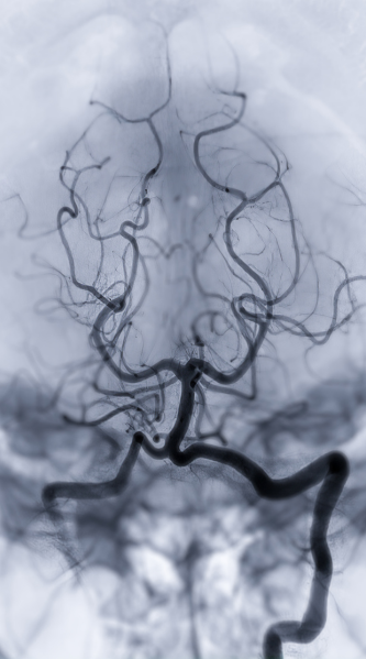 Dra. Rafaella Monteiro Silva Pinto | Neurologista em São Paulo | Neurologista São Paulo | Neurovascular em São Paulo | Neurovascular São Paulo | Medicina do Sono em São Paulo | Medicina do Sono São Paulo | Especialista em Sono | Especialista em AVC | Neurologista Online | Neurologia Sem Fronteiras | Consulta Online com Neurologista | Neurologista Teleconsulta | Teleconsulta de Neurologia